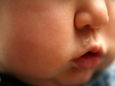 Sổ mũi ở trẻ em - Nguyên nhân, cách trị hiệu quả