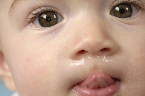 Nguyên nhân gây sổ mũi ở trẻ và cách điều trị